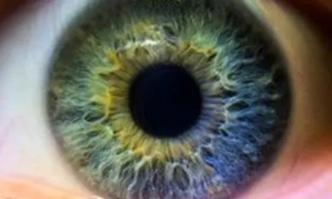 Phát hiện nhiều gene 'phụ' có thể làm thay đổi màu mắt