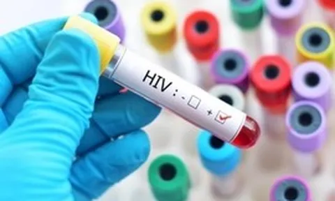 Quy định mới về cấp giấy chứng nhận bị phơi nhiễm HIV do tai nạn rủi ro nghề nghiệp