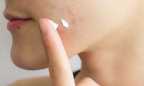 Thu hồi 5 sản phẩm mỹ phẩm của Công ty Kencare Việt Nam