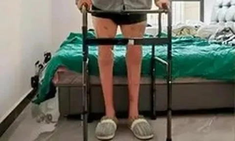 Lần đầu tiên trên thế giới: Bác sĩ Trung Quốc nối thành công hai chân đứt lìa
