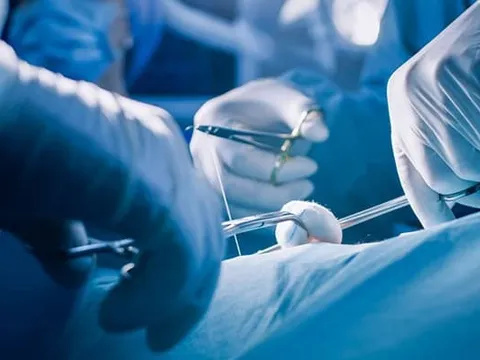 Mổ cắt bỏ khối u 'khủng' làm biến dạng mặt cô gái suốt 15 năm