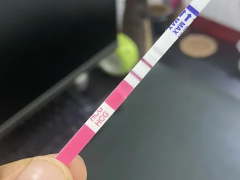 Làm sao vượt qua thời gian căng thẳng và hồi hộp trên hành trình tìm con bằng IVF?