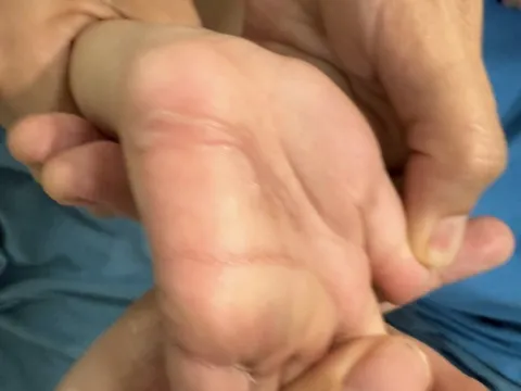 Xuất hiện 'những con đường ngoằn ngoèo kỳ lạ' trong lòng bàn tay trẻ 4 tuổi