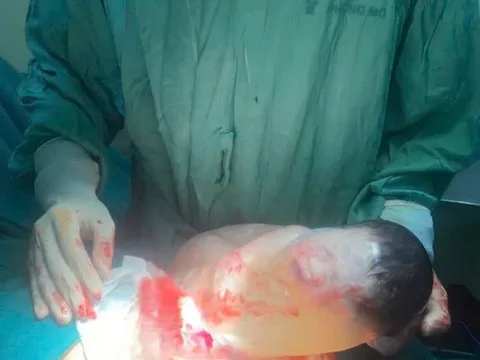 Hiếm gặp: Bé sơ sinh chào đời còn nguyên trong bọc ối