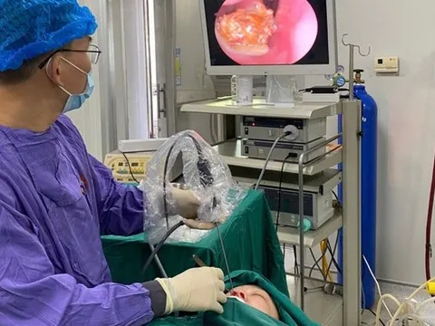 Tắc mũi kéo dài, đi khám, người đàn ông 34 tuổi sốc nặng khi phát hiện "bí mật đáng sợ"