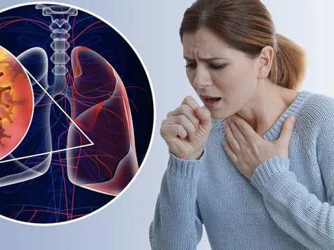 Dấu hiệu âm thầm tưởng vô hại nhưng có thể là ung thư phổi