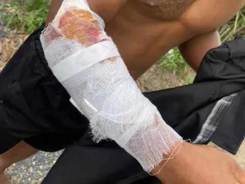 Cá sấu tấn công người ở Khánh Hoà, yêu cầu hạn chế tiếp cận khu vực sông Chò