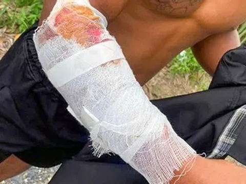 Cá sấu sổng khỏi khu du lịch, tấn công người dân