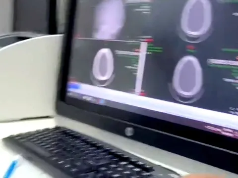 Gia đình bệnh nhân nghi bác sĩ tắc trách, bệnh viện nói chỉ thiếu sót khi in kết quả ra viện