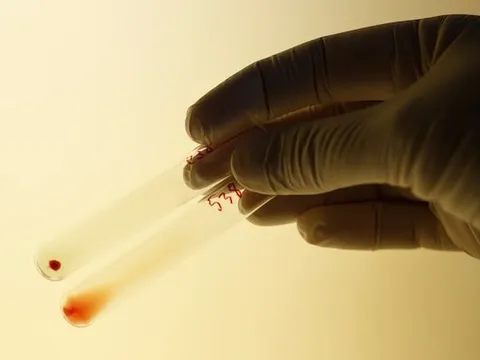 Đột phá: Biến thận nhóm máu A thành nhóm máu O, có thể ghép cho bất kỳ ai