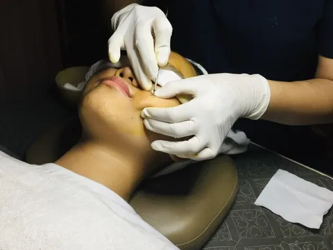 Căng thẳng tâm lý có phải là 'thủ phạm thầm lặng' khiến làn da xuống cấp?