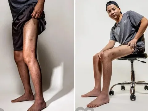 Tình trạng bất ổn của Khoa Pug