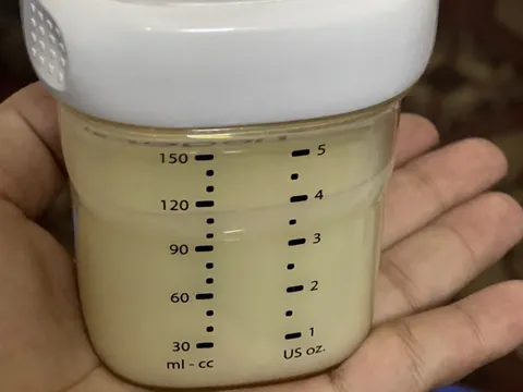 Sữa mẹ không phải thực phẩm đơn thuần mà tiềm ẩn mầm bệnh nếu vắt, trữ không đúng