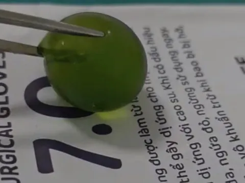 Nuốt phải hạt nở, bé 13 tháng tuổi nôn ói, tắc ruột