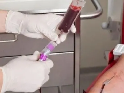 Nhiều tồn tại trong công tác tiếp nhận và cung cấp máu