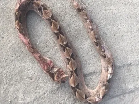 Người đàn ông 27 tuổi suýt mất mạng vì tự ý chữa bệnh theo “kiểu lạ đời"