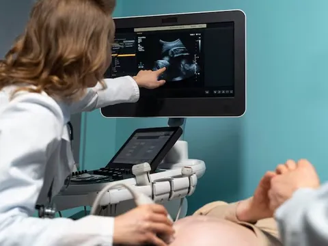 Siêu âm tim thai giúp phát hiện các bất thường ngay từ trong bụng mẹ