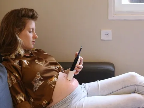 Thiết bị cầm tay giúp mẹ bầu tự siêu âm tại nhà