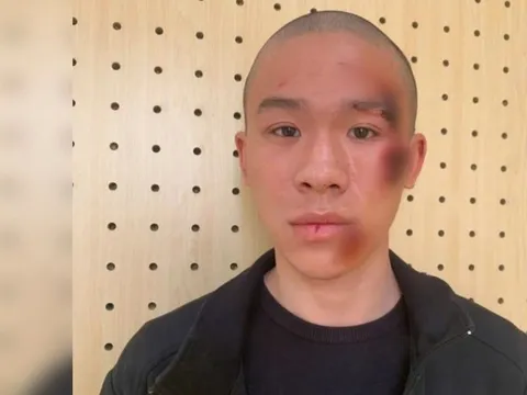 Tạm giữ hình sự đối tượng "trẻ trâu" lao xe “thông chốt” khiến CSGT bị thương