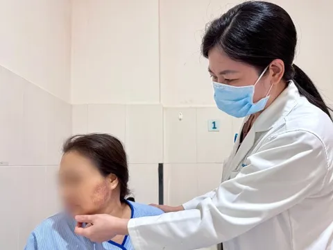 Nhập viện do trị nhức mỏi bằng chích lể, giác hơi