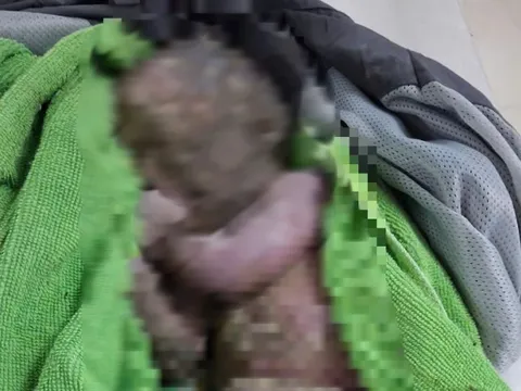 Cứu sống trẻ sơ sinh bị bỏ rơi đã ngừng tim, người đầy bùn đất