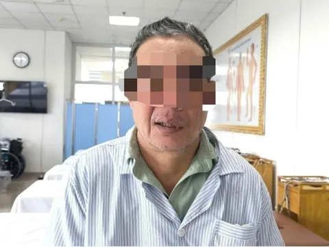 Rét đậm, nhiều người nhập viện vì méo miệng, lệch mặt