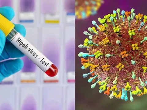 Bộ Y tế hoả tốc yêu cầu cơ sở khám chữa bệnh chủ động phòng chống bệnh do virus Nipah
