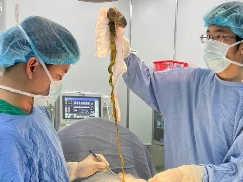 Phẫu thuật lấy búi tóc chiếm hết dạ dày bé trai 6 tuổi