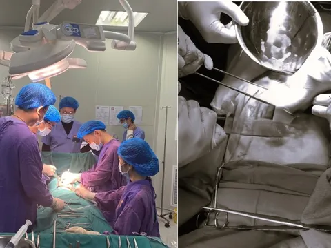 Dọn nhà đón Tết, người đàn ông ngã từ trên cao xuống, nguy kịch