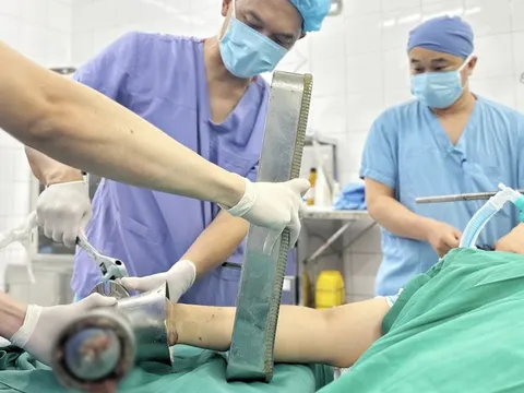 Kẹt nguyên bàn tay trong máy xay thịt, người phụ nữ phải phẫu thuật cắt cụt chi