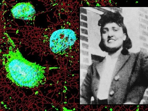 Người phụ nữ qua đời 70 năm nhưng 'tế bào bất tử' vẫn cứu hàng triệu người