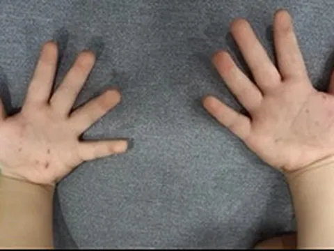 Con đang chơi bỗng khóc ngặt nghẽo, mẹ sững sờ khi phát hiện “bí mật”