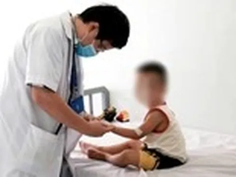 Số ca mắc tay chân miệng tại Khánh Hòa tăng gấp 4 lần, bước vào chu kỳ bùng phát