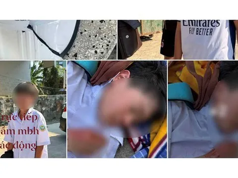 Nam sinh lớp 6 bị đánh hội đồng chỉ vì không cho mượn xe đạp