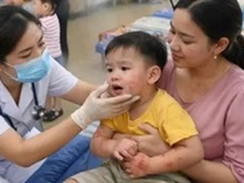 Tay chân miệng ở Đà Nẵng tăng nhanh, vượt ngưỡng trung bình nhiều năm