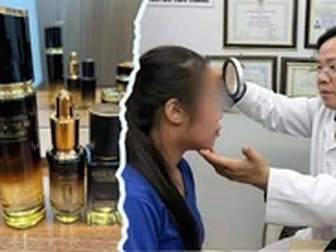 Cô gái trẻ viêm da, hỏng mặt vì dùng mỹ phẩm trôi nổi