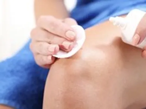 Nhiều người vẫn dùng oxy già để sát trùng vết thương: Có nên không?