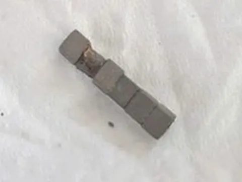 Cấp cứu bé trai nuốt phải nhiều viên nam châm