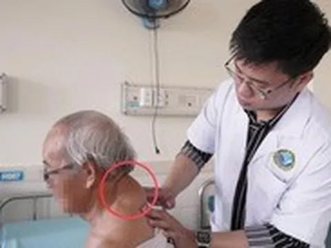 Phẫu thuật bóc khối u 'khổng lồ' vùng sau cổ suốt hơn 40 năm cho cụ ông 72 tuổi