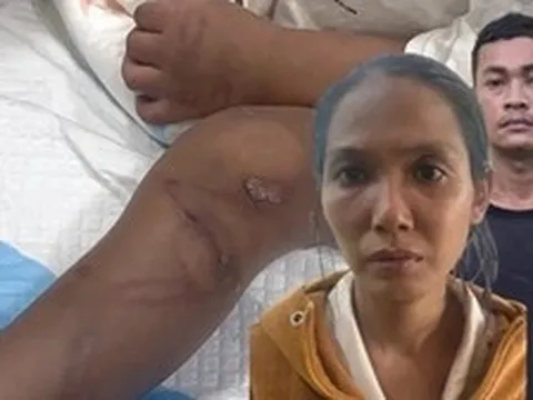 Vụ bé trai 2 tuổi bị mẹ ruột và người tình bạo hành dã man: Nhân chứng chưa hết ám ảnh, tiết lộ tình tiết đau lòng