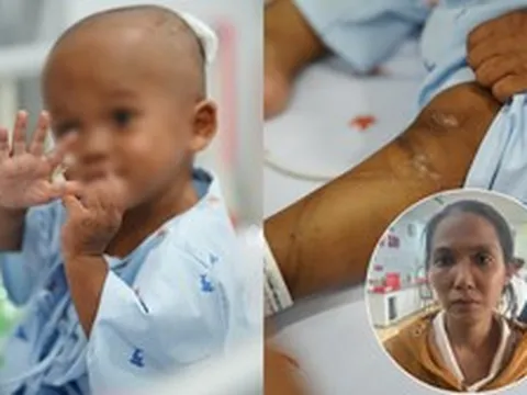 Hình ảnh xúc động của bé trai 2 tuổi bị bạo hành: Đã biết cười, chơi đùa trở lại nhưng phải theo dõi dập phổi