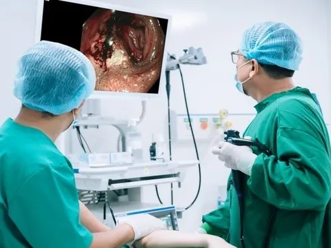 Đang khỏe mạnh, người đàn ông 41 tuổi bất ngờ nhập viện vì xuất huyết tiêu hóa