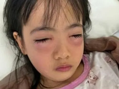 Chơi bong bóng xà phòng, bé 5 tuổi nguy kịch phải cấp cứu, sự thật khiến mẹ "sốc nặng"