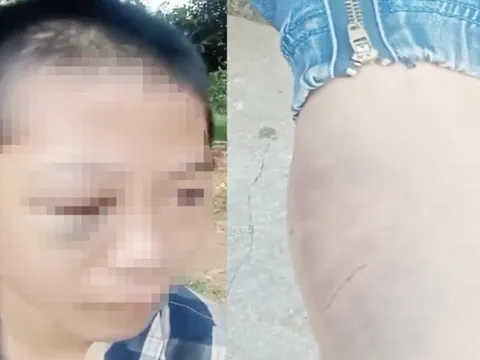 Xôn xao clip học sinh lớp 6 nghi bị người thân bạo hành