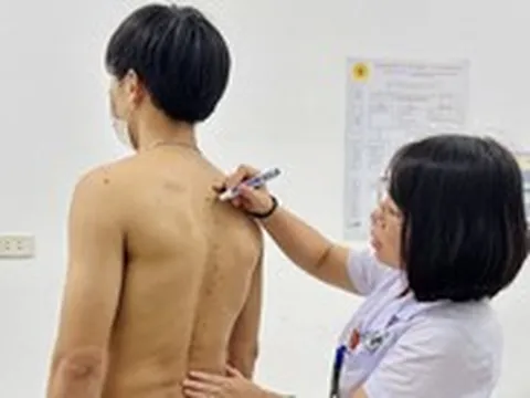 Bác sĩ cảnh báo dấu hiệu đau lưng bất thường không nên bỏ qua