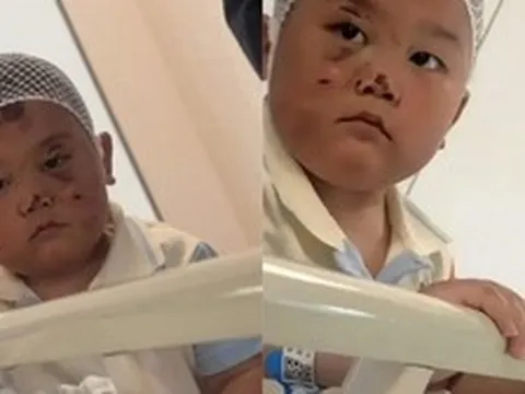 Bé trai 3 tuổi túc trực chăm mẹ sau tai nạn nghiêm trọng: Mặc dù chính bé bị nhiều vết thương đau đớn nhưng vẫn theo sát mẹ không rời