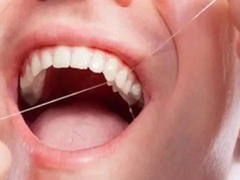 Lời khuyên cho những người sử dụng chỉ nha khoa hàng ngày