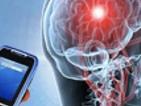 Bệnh u não có liên quan đến sóng điện thoại?