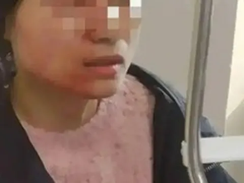 Cô giáo tiểu học bị đâm vỡ nhãn cầu vì can ngăn học sinh đánh nhau: Kẻ thủ ác không bị xử phạt vì chưa đủ 14 tuổi!