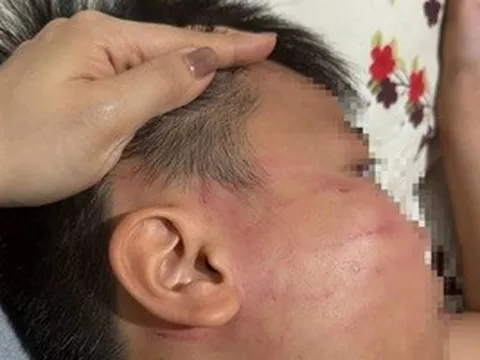 Thầy giáo Ấn Độ bị tố tát học sinh lớp 4 trong lớp học thêm ở Gia Lai